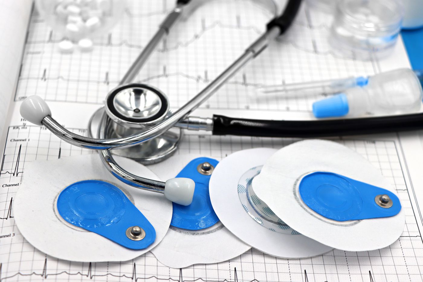 Eletrodos e traçado cardíaco utilizados na monitorização por Holter.